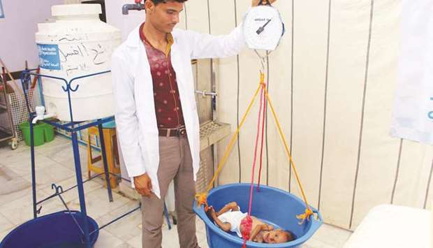 A Yemeni child suffering from severe malnutrition is weighed in a hospital in the northern district of Abs in the northwestern Hajjah province, yesterday.