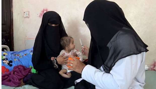 A Yemeni mother holds her malnourished child as a nurse tries to feed the baby at Al-Mudhafar hospital in Taez