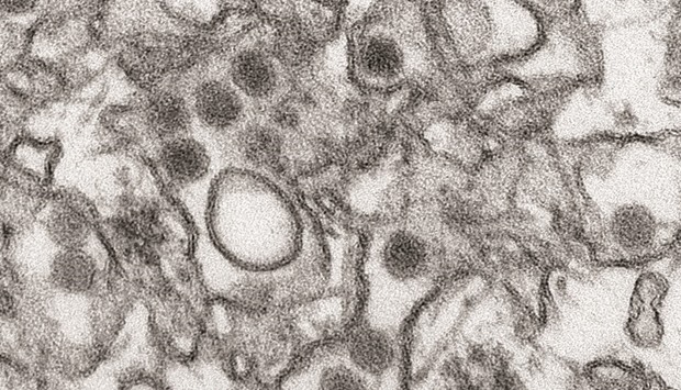 A transmission electron micrograph (TEM) shows the Zika virus, in an undated photo provided by the US Centres For Disease Control and Prevention (CDC) in Atlanta, Georgia. The CDC extended its travel warning to another eight countries or territories that pose a risk of infection with Zika, a mosquito-borne virus spreading through the Caribbean and Latin America.