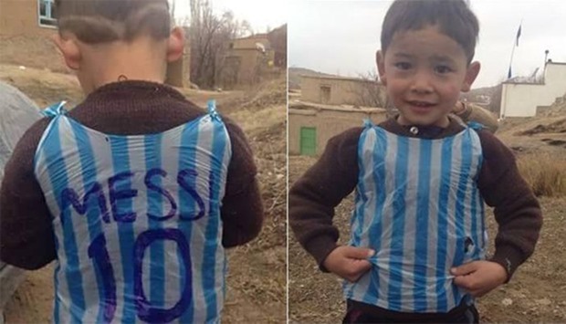 five-year-old Afghan boy