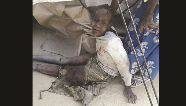This handout image received courtesy of Doctors Without Border (MSF) on January 17 shows a wounded child after an air force jet bombarded a camp for those displaced by Boko Haram Islamists, in Rann, northeast Nigeria.