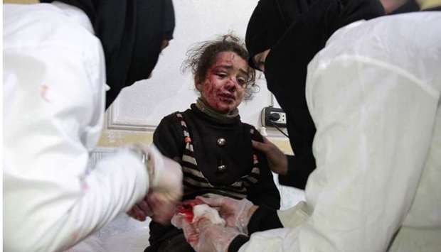 A Syrian girl who was injured in bombardment cries as she receives treatment at a make-shift hospital in the besieged rebel-held town of Douma, on the outskirts of the capital Damascus.