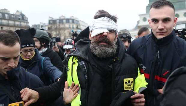 Jerome Rodrigues, one of the leaders of the yellow vest movement is evacuated after getting injured in the eye during clashes between protesters and riot police