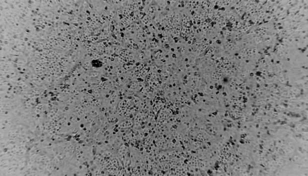 A still image taken from a time lapse video shows novel coronavirus 2019-nCov growing in Vero E6 cells, in Melbourne, Australia