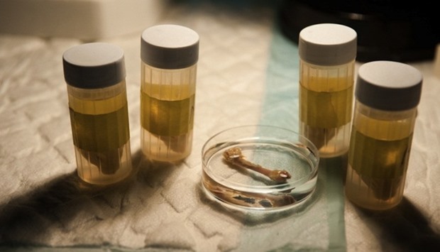 Vials of fat used in the bone-construction process