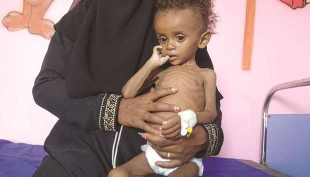 A recent photo shows a Yemeni mother hold her malnourished child as they wait for treatment in a medical centre in the village of Al Mutaynah, in the Tuhayta province, western Yemen.