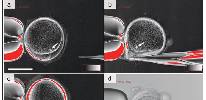 An undated handout photo showing a series of photos of therapeutic cloning of an adult cell provided by Robert Lonza of Advanced Cell Technology.
