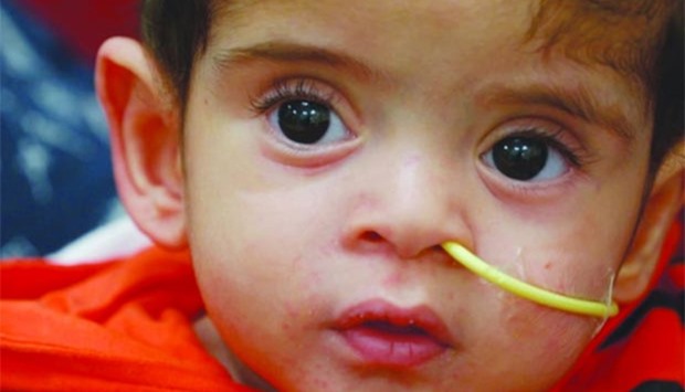 Baby Mohamed, whose life was saved. 