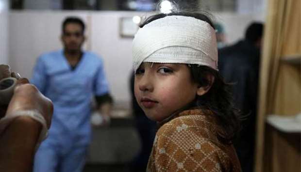 A wounded Syrian girl receives treatment at a makeshift hospital in Kafr Batna following Syrian government bombardments on the besieged Eastern Ghouta region in Damascus on Wednesday.