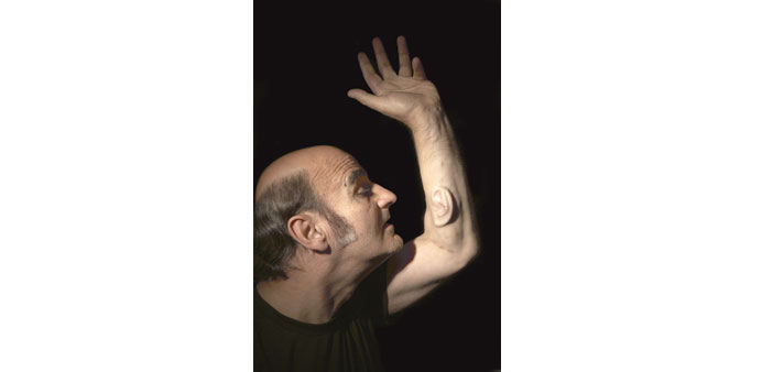 Australian artist and academic Stelarc revealing the implanted ear on his arm. 