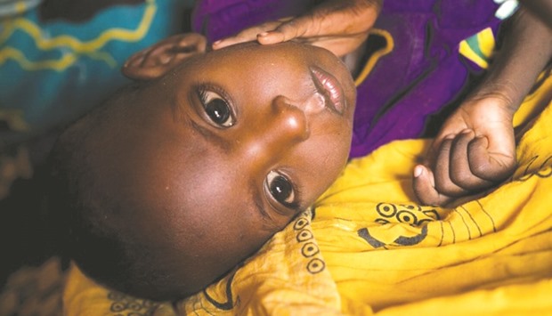 Ahmed, age two, who is malnourished, lies on the ground of his familyu2019s home in Uusgure, Puntland.