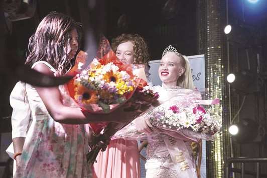 Zimbabweu2019s first Miss Albino Sithembiso Mutukura (right) receives a bouquet of flowers after receiving her crown during the inaugural Miss Albinism beauty contest in Harare on Friday night.