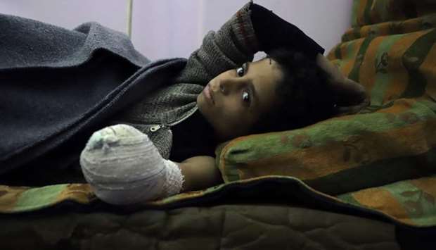 Syrian child Khaled al-Ghorani lies at a clinic after he had his hand amputated in Kafar Batna in the Syrian rebel enclave of Eastern Ghouta