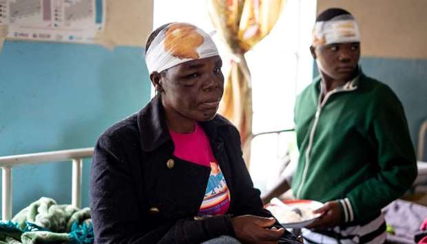 Jane Chitsuro, a cyclone survivor, sits on a hospital bed at Chimanimani Rural district hospital, Manicaland Province, eastern Zimbabwe