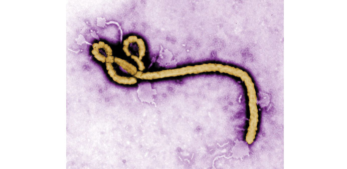    A colourised transmission electron micrograph revealing some of the ultrastructural morphology displayed by an Ebola virus virion.