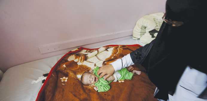 A nurse attends to Ali Mohamed al-Tawaari, a six-month-old malnourished boy, at a hospital in Sanaa. 