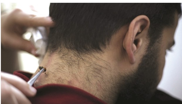 A Palestinian patient, who suffers from nerve problems in his neck and back, receives bee-sting therapy at Rateb Samouru2019s clinic in Gaza City.