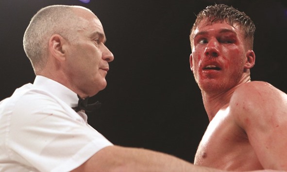 Nick Blackwell moments before his fight with Chris Eubank Jr was halted in the 10th round by the referee.