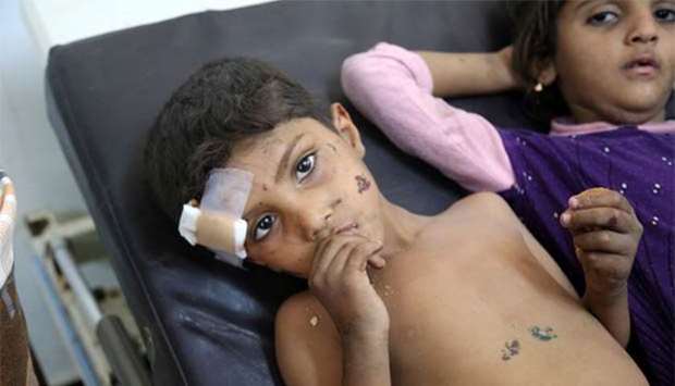 Yemeni children who were injured in air strike in the district of Al-Hali in Hodeida province on Monday receive treatment at a hospital.