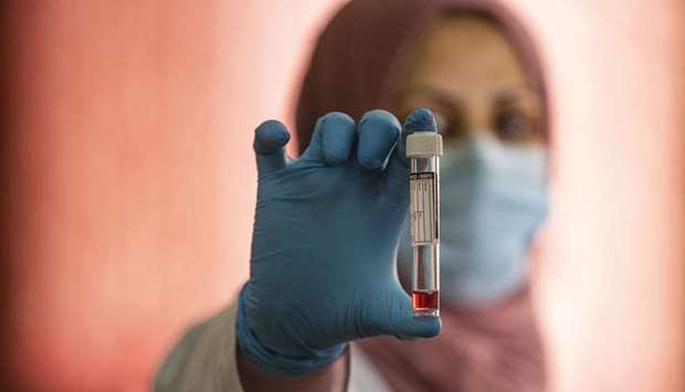 VTM: A member of the Covid-19 Crisis Cell holds a vial containing Virus Transport Medium (VTM), a substance that preserves nasal swab specimens while being transported to labs, produced at Basra university in southern Iraq.      AFP