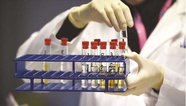In this file photo taken on December 15, 2015 a technician holds urine samples at the French national anti-doping laboratory in Chatenay-Malabry, outside Paris. The global reduction in travel and human contact over the last year may have played an important role in battling Covid-19 but it has added a new layer of complexity to fighting the doping cheats ahead of the Tokyo Olympics. AFP