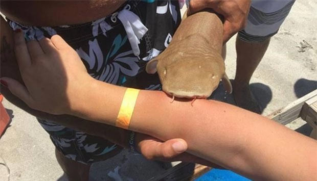 The woman was bitten by the shark while bathing at a beach