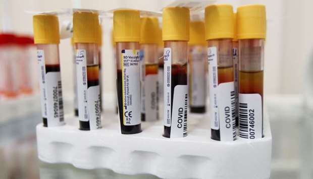 Vials with blood samples are pictured at a clinic providing testing for the coronavirus disease and antibodies, after authorities launched free mass screening for residents in the Russian capital, in Moscow, Russia