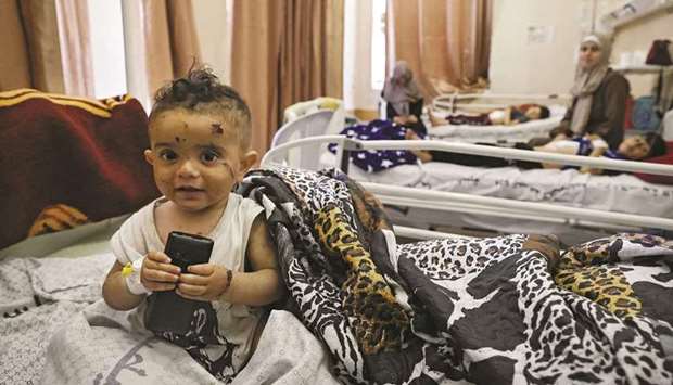 A Palestinian child, who was wounded in Israeli air strikes on the Gaza Strip, receives treatment at Al-Shifa Hospital in the Palestinian enclave on Sunday.