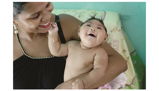 A MOTHERu2019S LOVE: u201cSheu2019s everything in my life. It doesnu2019t matter what she has, for me, itu2019s nothing,u201d Maria da Luz Mendes Santos says about her daughter, Heloyse, who was born with microcephaly. u201cShe brought a lot of happiness to my family.u201d