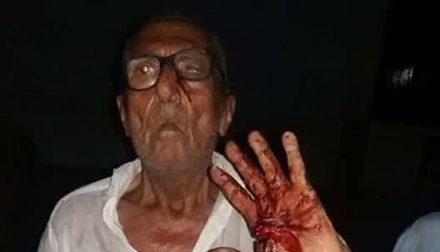 Gokal Das was attacked in Ghotki district of Sindh province just before sunset. 