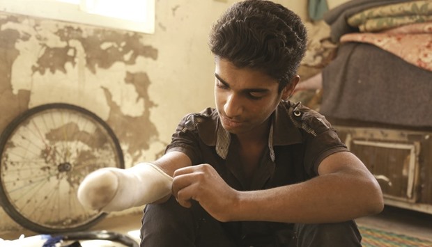 Syrian teenager Bashar Qassem adjusts the bandage on amputated arm as his sits in his house in the northeastern town of Al-Hol in Syriau2019s Hasakeh province.