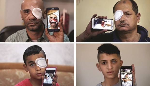 A combination of pictures taken in March and April 2016 in Jerusalem shows Palestinian men and youths posing with a mobile phone bearing a picture of them after they were wounded by a sponge-tipped bullet used by Israeli security forces to disperse demonstrations.