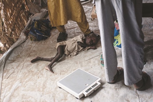 This photo taken on June 30 shows a boy suffering from severe acute malnutrition lying on the ground at one of the Unicef nutrition clinics, in the Muna informal settlement, which houses nearly 16,000 IDPs (internally displaced people) in the outskirts of Maiduguri capital of Borno State, northeastern Nigeria.