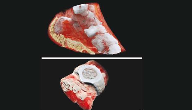 These handout pictures released on July 12 by MARS Bioimaging Ltd shows 3D images of a wrist (with a watch showing part of the finger bones in white and soft tissue in red) and an ankle with bones in white and soft tissue in red.