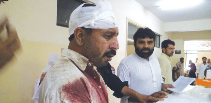 A man, who was injured in a blast, stands at a hospital in Parachinar yesterday.