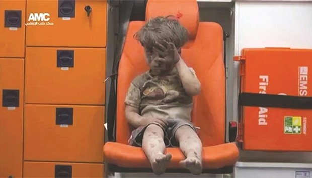 A young Syrian boy is covered in dust and blood in Aleppo, an image that has shocked the world.
