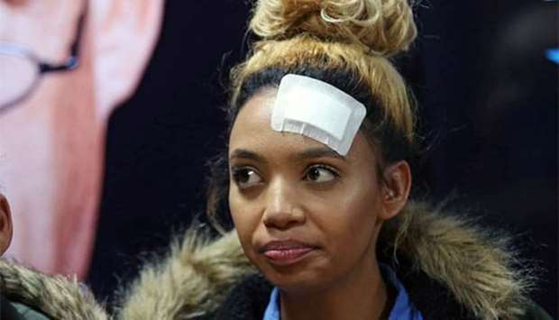 Gabriella Engels, who claims to have been assaulted by Grace Mugabe, is pictured in Pretoria.