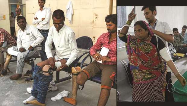 LEFT: In this photograph taken on June 13, 2017, 50-year-old Rajkumar Saini (second right), who suffered a road accident in 2004, gets his fourth prosthetic leg at the Bhagwan Mahaveer Viklang Sahayata Samiti non-profit organisationu2019s main branch in Jaipur. RIGHT: A worker helps an accident victim with a prosthetic hand at the Bhagwan Mahaveer Viklang Sahayata Samiti non-profit organisationu2019s main branch in Jaipur.