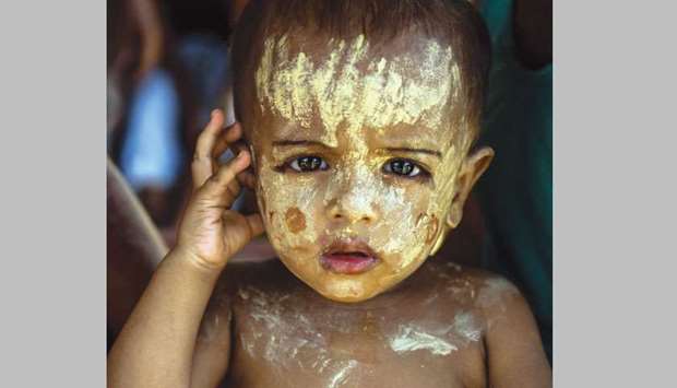 Rohingya refugee boy Mohamed Ismail, two-months-old, has been smeared with thanaka face powder to protect himself from the sun at the Kutupalong camp in Ukhia, near Coxu2019s Bazar, Bangladesh.