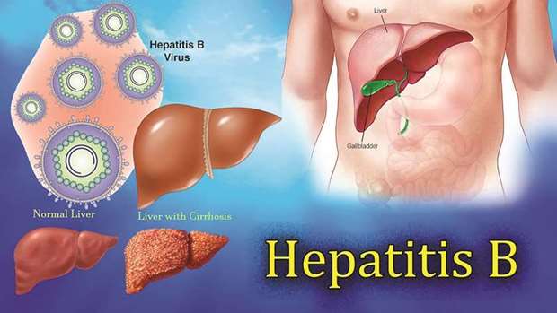 SYMPTOMS: Hepatitus B is imperative to be cautious of symptoms such as extreme fatigue, appetite loss, jaundice, pain in the liver area, nausea and vomiting.