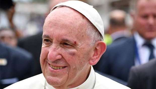 Pope Francis shows a bruise around his left eye and eyebrow in Cartagena, Colombia, on Sunday.