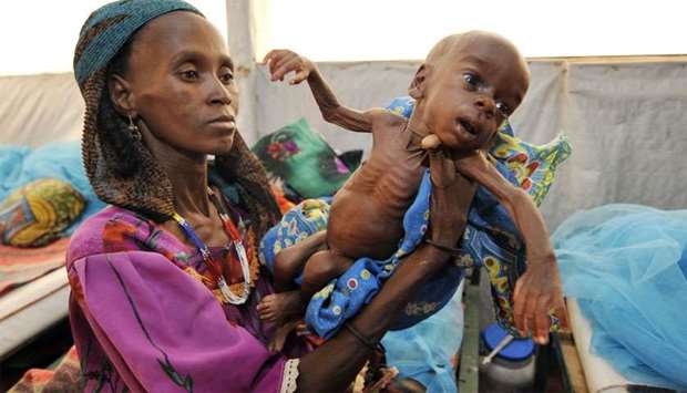 A woman shows her malnourished baby at an intensive nutritional rehabilitation center (CRENI) in Tanout, southern Niger.