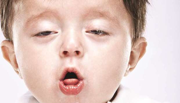 STATISTICS: In 2012, the United States had the highest number of whooping cough cases in more than 50 years with 48,277 reported cases and 20 deaths.