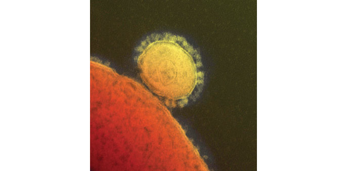 Particles of the Middle East respiratory syndrome (Mers) coronavirus  seen in a colourised transmission electron micrograph.