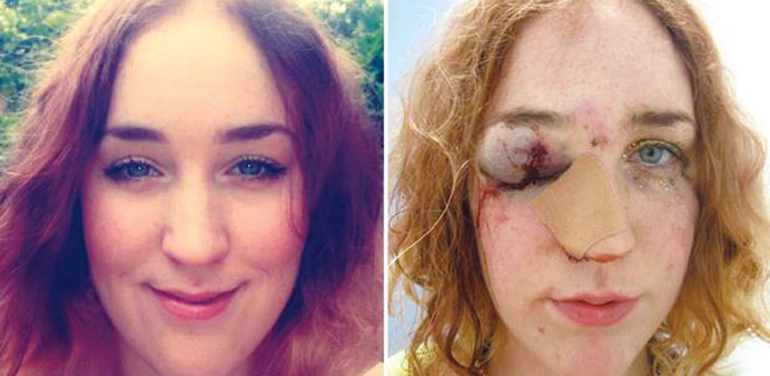 Images of Mary Brandon after she was allegedly assaulted at Notting Hill Carnival.