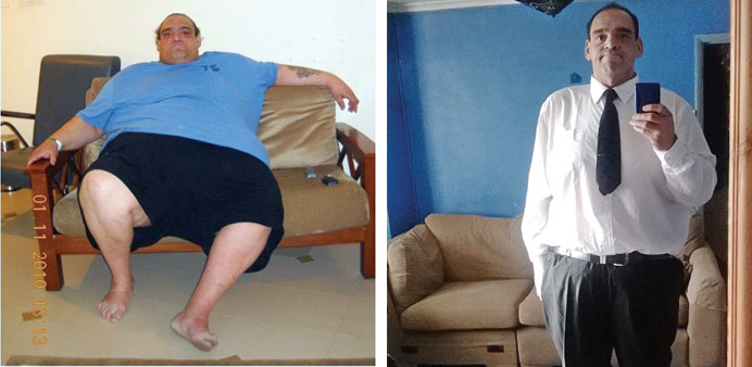 Smith before and after the operation.
