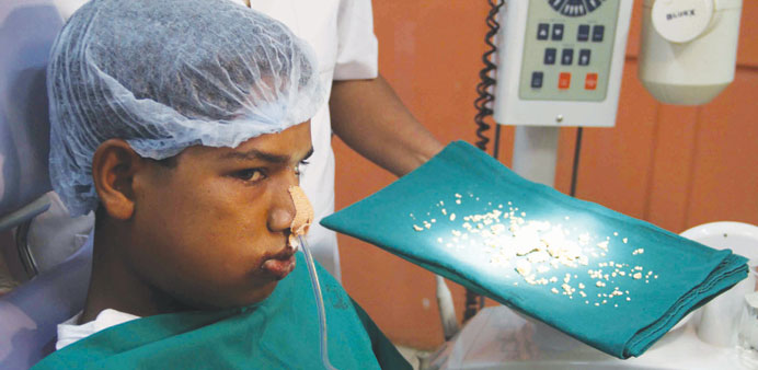  Ashik Gavai and the record 232 tiny teeth extracted from his mouth.