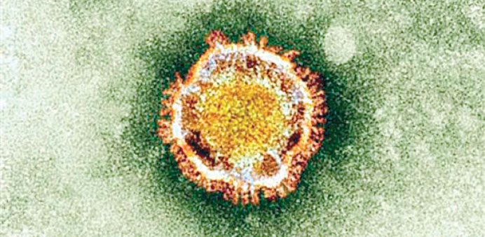 The coronavirus seen under an electron microscope.