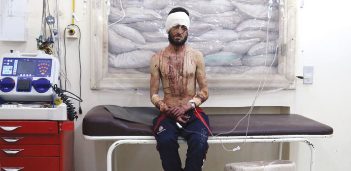 A wounded man sits as he is treated at a makeshift hospital following a reported u201cbarrel bombu201d attack by Syrian government forces on May 4 in the Al S